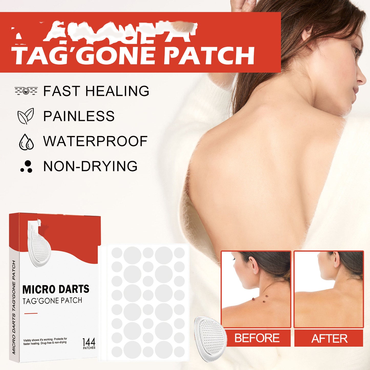 Acne Patch