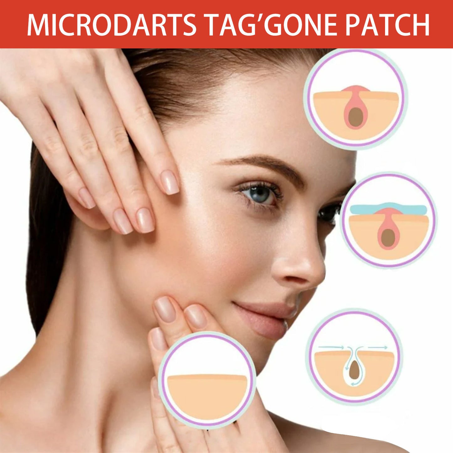 Acne Patch