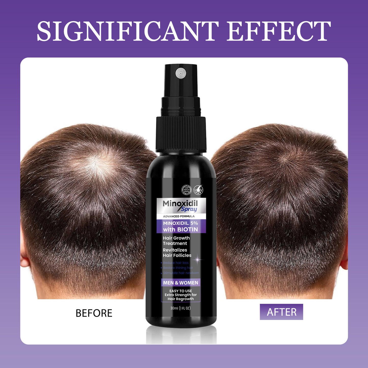 Minoxidil Spray mit Biotin
